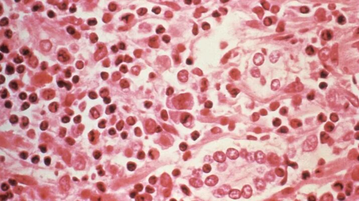 Tiga Penumpang Tewas di Kapal Pesiar Atlantik, Diduga Terpapar Hantavirus